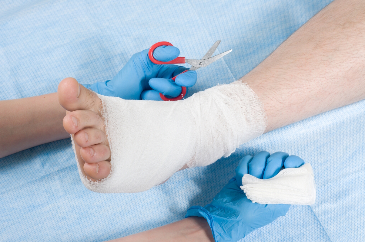 Common Mistakes in Wound Care